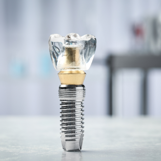 Discussing expenses of dental implant treatment.